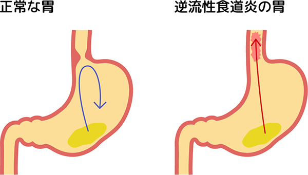 目眩（めまい）とは